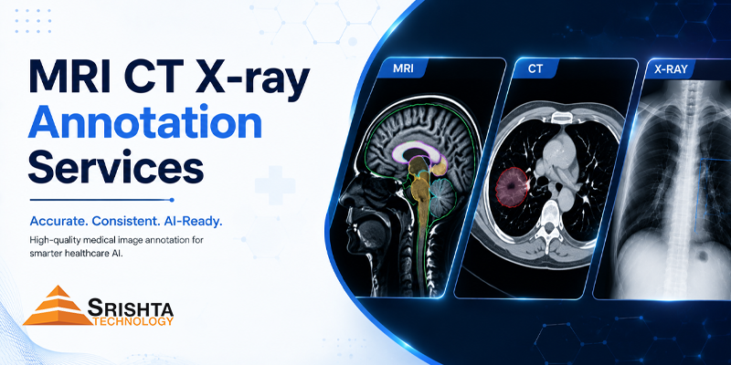MRI CT X-ray Data annotation services India