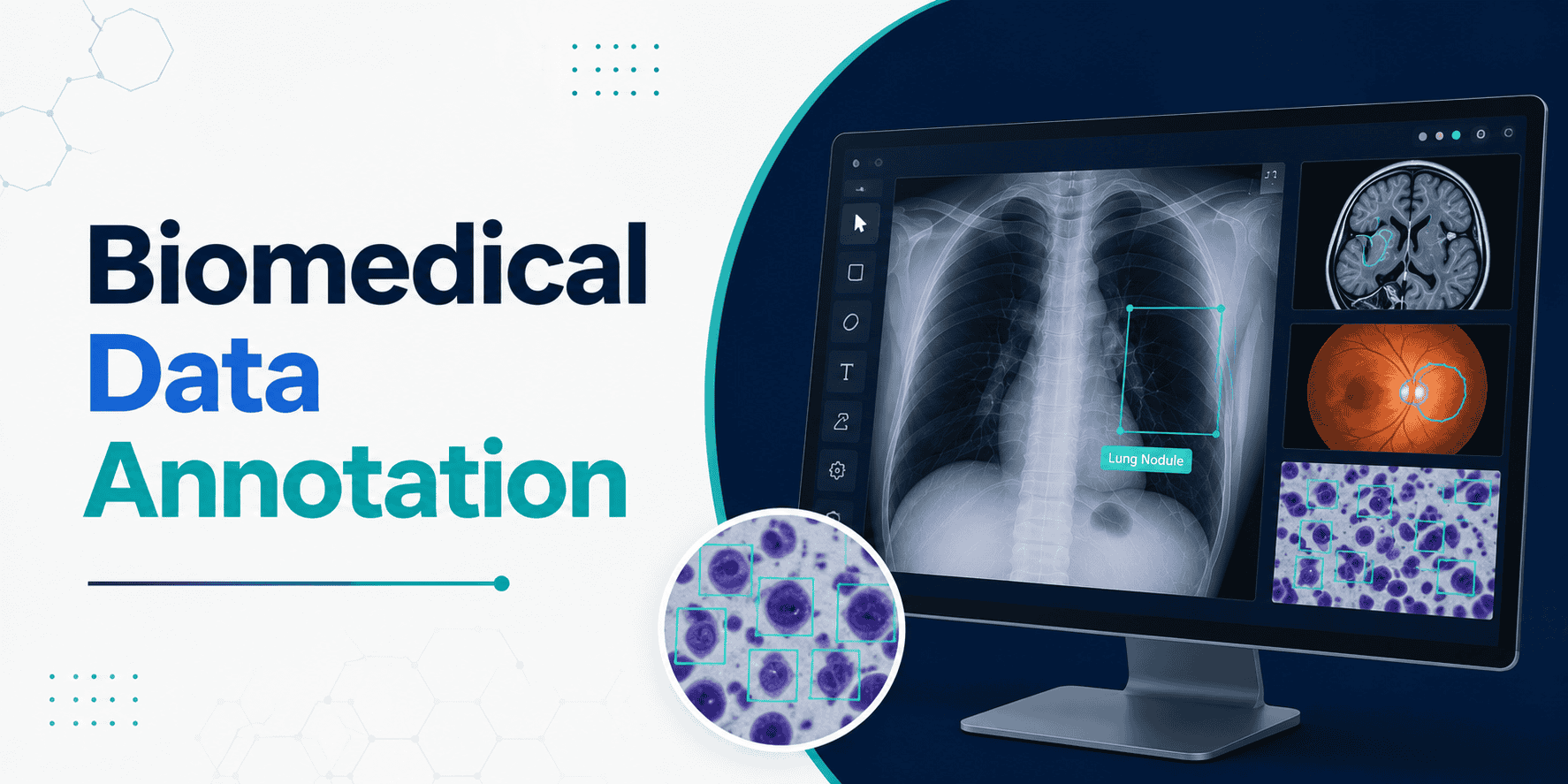 Biomedical Data Annotation Company In India