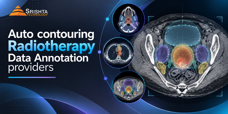 Auto Contouring Radiotherapy Data Annotation Providers